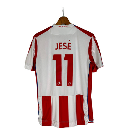 Stoke City 17/18 - Jesé (S)